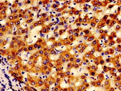 Polyclonal Rabbit anti-Human LACE1 Antibody (IHC, WB)