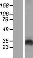GAMT Protein (Over-Expression Lysate Myc-DDK (Flag))
