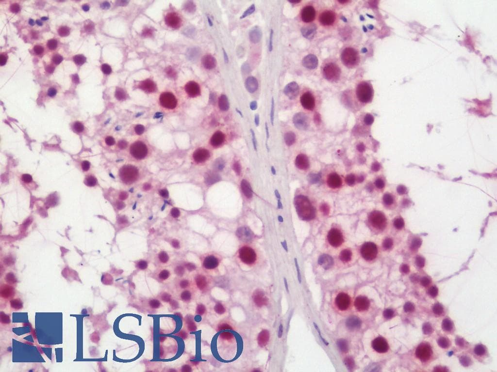 IHC-plus™ FEN1 Antibody (aa250-300)