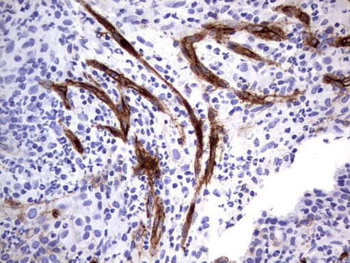 Monoclonal Mouse anti-Human MCAM / CD146 Antibody (clone UMAB154, Carrier-free, IHC, WB)