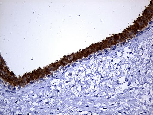NAT1 / AAC1 Antibody (clone OTI6D7, Carrier-free)