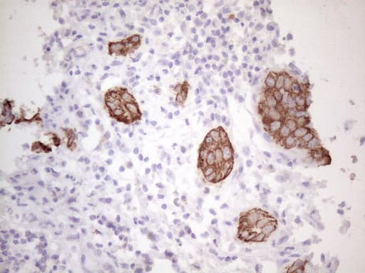 KRT16 / CK16 / Cytokeratin 16 Antibody (clone OTI2H8, Carrier-free)
