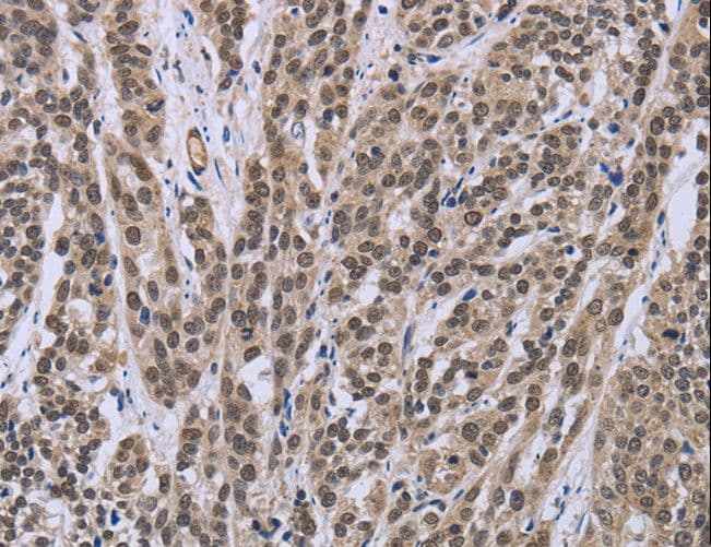 IPO8 / Importin 8 Antibody