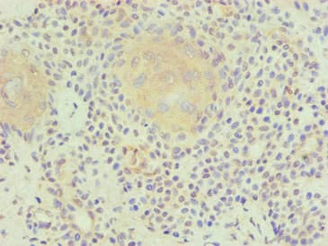 LP-PLA2 / PLA2G7 Antibody (clone 2A1B6)