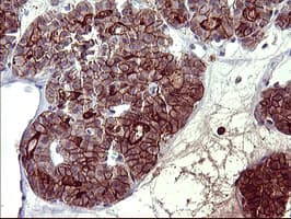PDGFRB / PDGFR Beta Antibody (clone OTI1E8, Carrier-free)