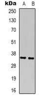 CCND1 / Cyclin D1 Antibody