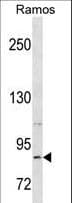 Polyclonal Rabbit anti-Human RXFP2 / LGR8 Antibody (aa692-721, WB)