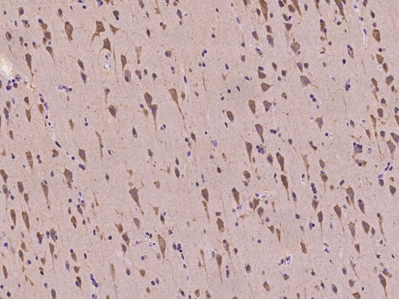 DLGAP1 Antibody