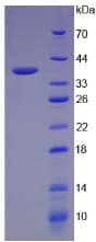 Human LGALS8 / Galectin 8 Protein (Recombinant His)