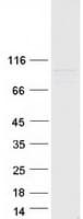 Human TRAK1 Protein (Recombinant Myc-DDK (Flag))