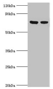 TCTN2 Antibody (aa420-670)