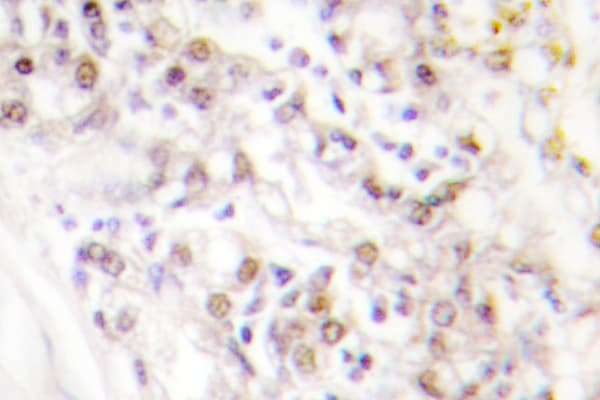 RAB6KIFL / KIF20A Antibody (Ile524)
