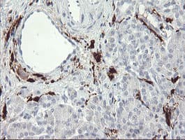 F13A1 / Factor XIIIa Antibody (clone 1H2, Carrier-free)