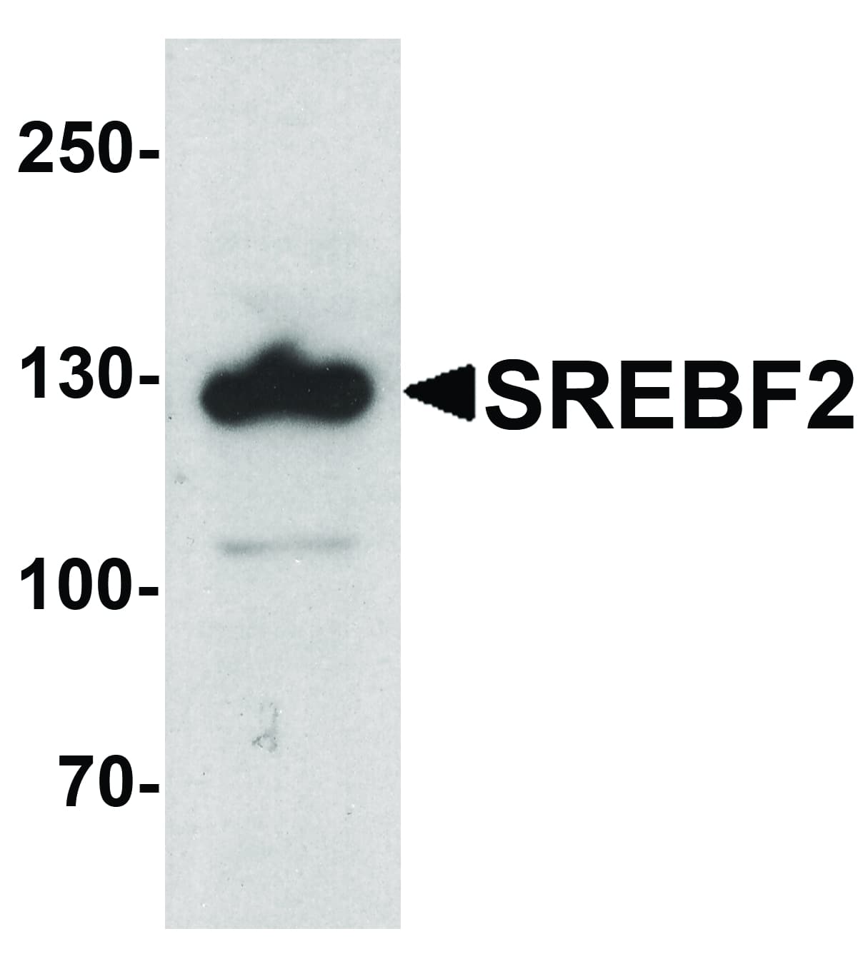 IHC-plus™ Polyclonal Rabbit anti-Human SREBF2 / SREBP2 Antibody (IHC, IF, WB)