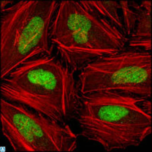 CHEK2 / CHK2 Antibody