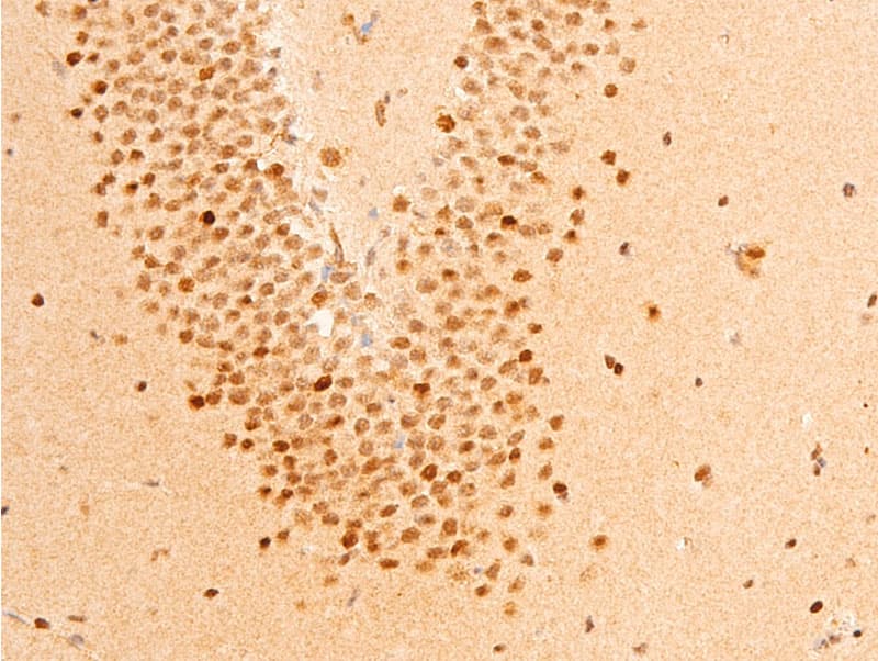 JUN / c-Jun Antibody (phospho-Ser63)