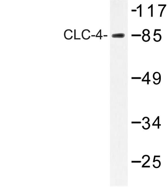 CLCN4 / CLC-4 Antibody (Glu254)
