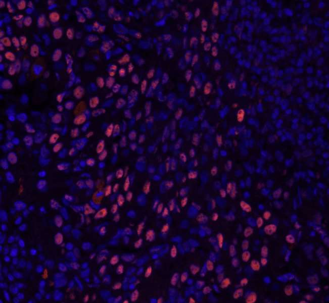 Polyclonal Rabbit anti-Human GTF2I / TFII I Antibody (aa950-C-term, IHC, IF)
