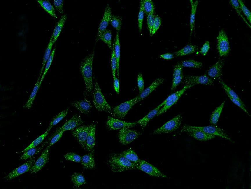 Polyclonal Rabbit anti-Mouse I-FABP / FABP2 Antibody (IF, WB)