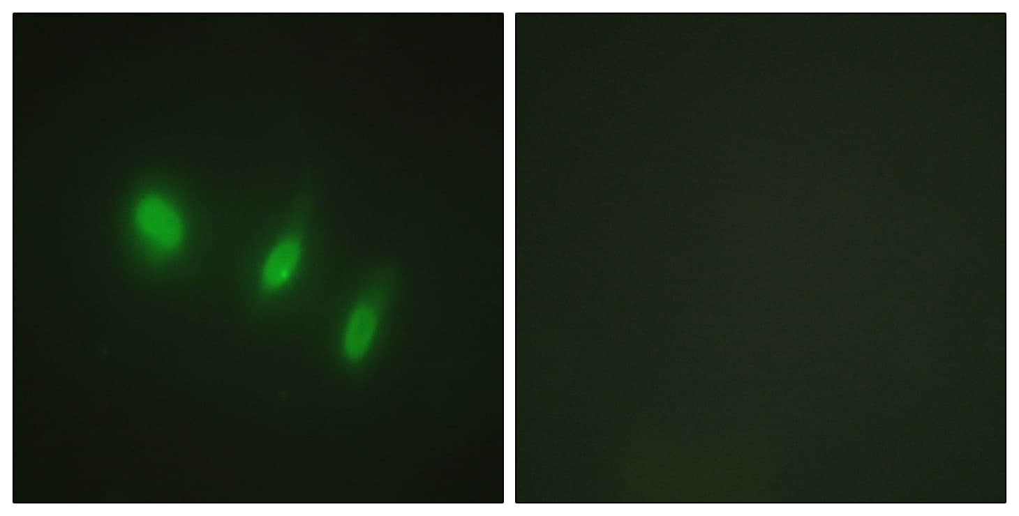 FOXO4 / AFX1 Antibody (aa417-466)