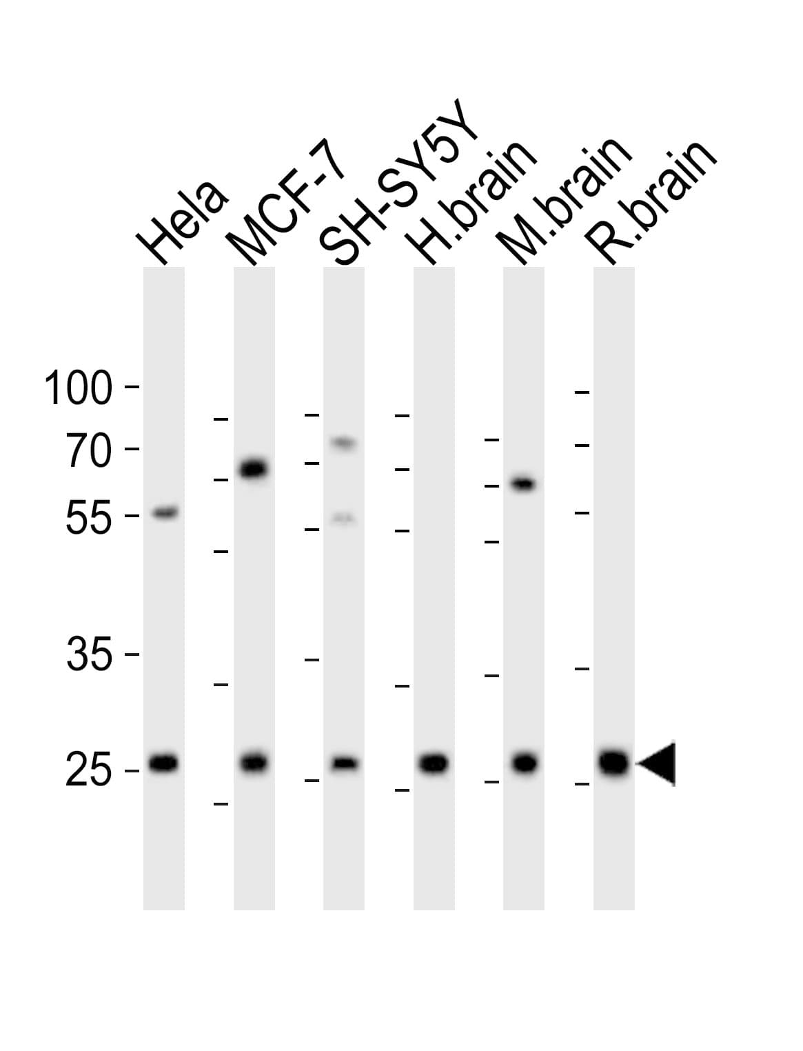 Polyclonal Rabbit anti-Human NTF3 / Neurotrophin 3 Antibody (aa89-120, WB)