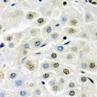 SSX5 Antibody