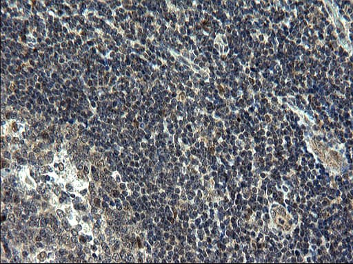 ZFAND3 / TEX27 Antibody (clone OTI1E9)