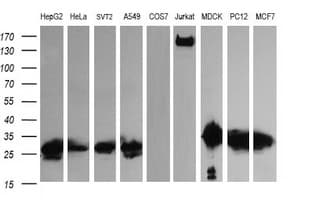 Monoclonal Mouse anti-Human LGALS3 / Galectin 3 Antibody (clone 1G8, Carrier-free, IHC, IF, WB)