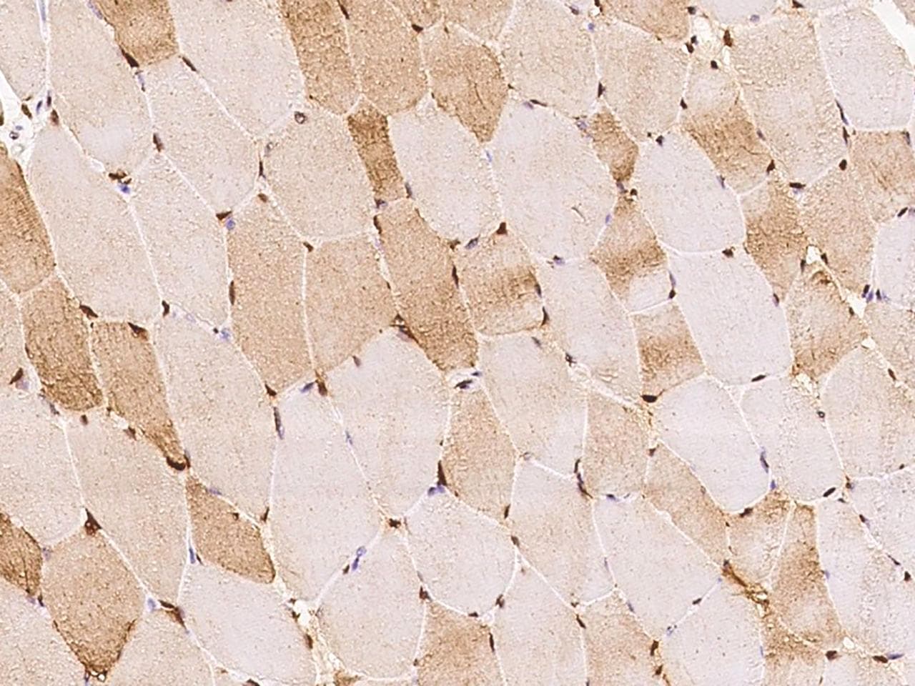 Polyclonal Rabbit anti-Human PGAM2 Antibody (IHC)