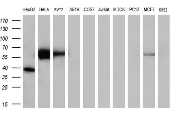 FOXO4 / AFX1 Antibody (aa206-505, clone OTI2C5, Carrier-free)