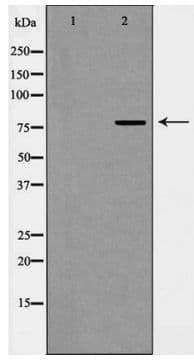 Polyclonal Rabbit anti-Human EZH2 Antibody (IHC, WB)