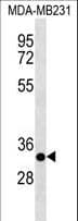 IHC-plus™ CAPNS2 Antibody (aa55-83)