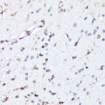 Polyclonal Rabbit anti-Human HIST2H2BE Antibody (IHC, WB)