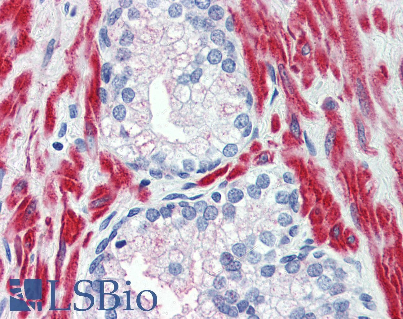 PathPlus™ TRPM8 Antibody (N-Terminus)