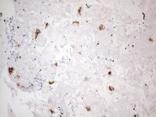 c-Kit / CD117 Antibody (aa27-308, clone OTI2B12, Carrier-free)