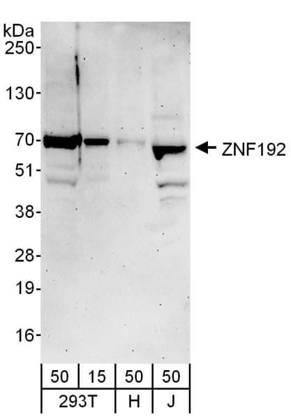 ZNF192 Antibody (aa528-578)
