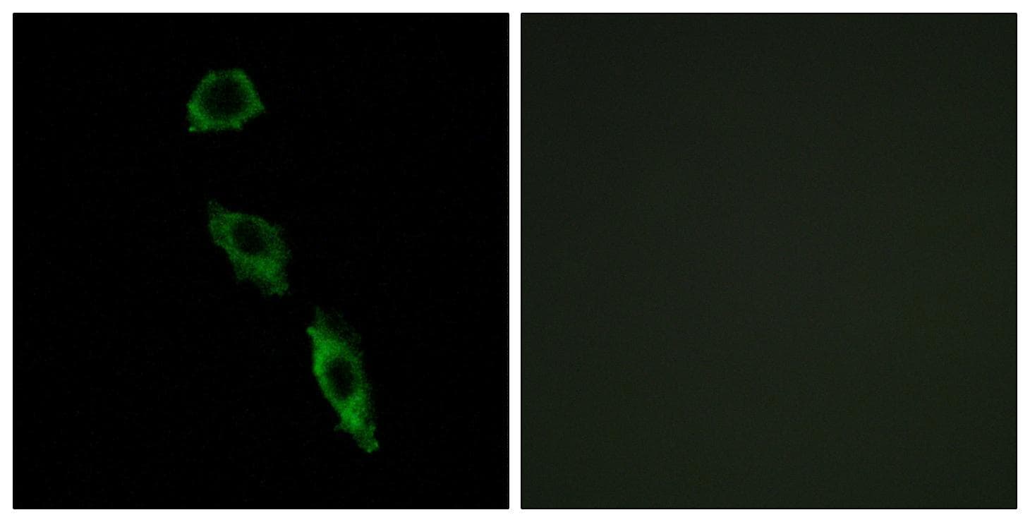 Erastin Antibody
