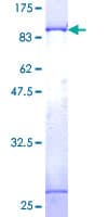 Human p58 / PSMD3 Protein (Recombinant GST)