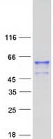 Human FAM90A8 Protein (Recombinant Myc-DDK (Flag))
