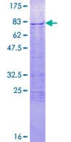 Human IRX6 Protein (Recombinant GST)