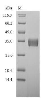 Mouse YWHAB / 14-3-3 Beta Protein (Recombinant 10His, N-terminus)
