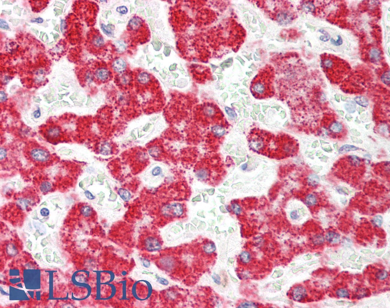 ALDH6A1 Antibody (aa323-372)