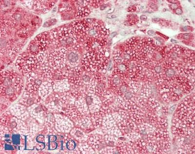 IHC-plus™ SLC46A1 / HCP1 Antibody (aa225-275)