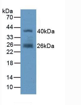 FAP Alpha Antibody (aa523-760)