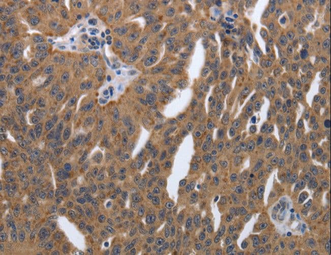 PDGF-AA Antibody