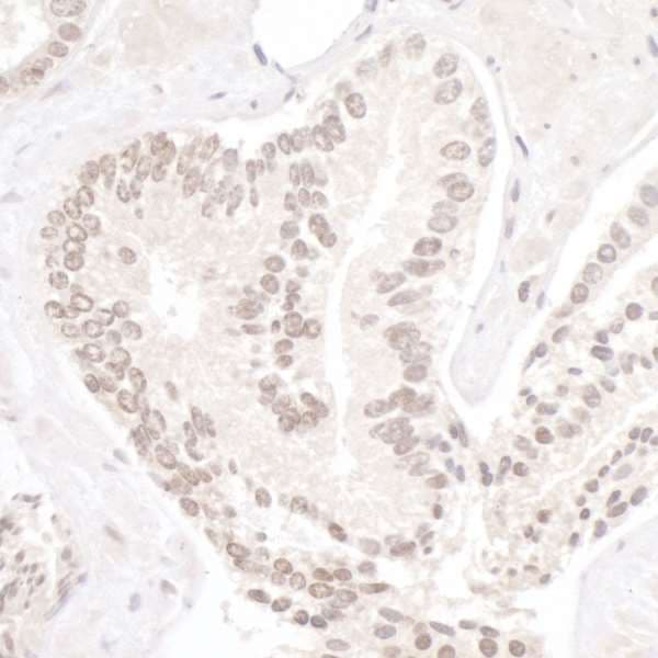 UHRF1 Antibody (aa275-325)