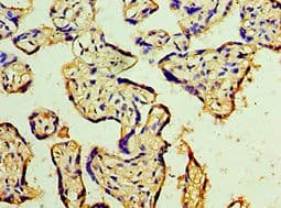 MAP2K3 / MEK3 / MKK3 Antibody (aa1-170)