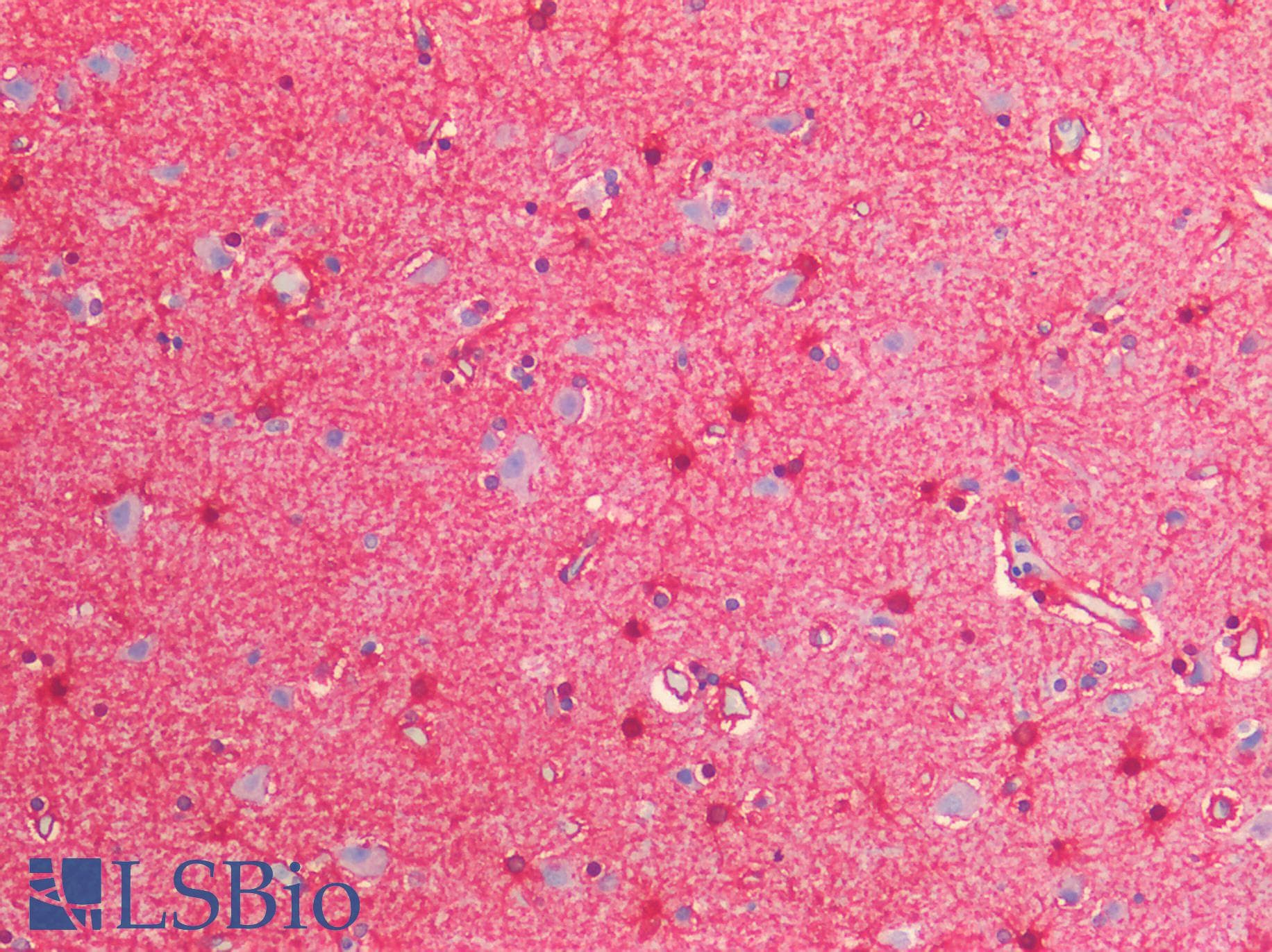 PathPlus™ Polyclonal Rabbit anti-Human GLUL / Glutamine Synthetase Antibody (IHC)