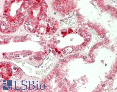 IHC-plus™ PDK1 Antibody (clone 4A11)