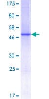 Human C1QG / Complement C1QC Protein (Recombinant GST)